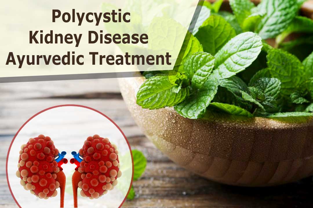 polycystic kidney disease Ayurvedic treatment