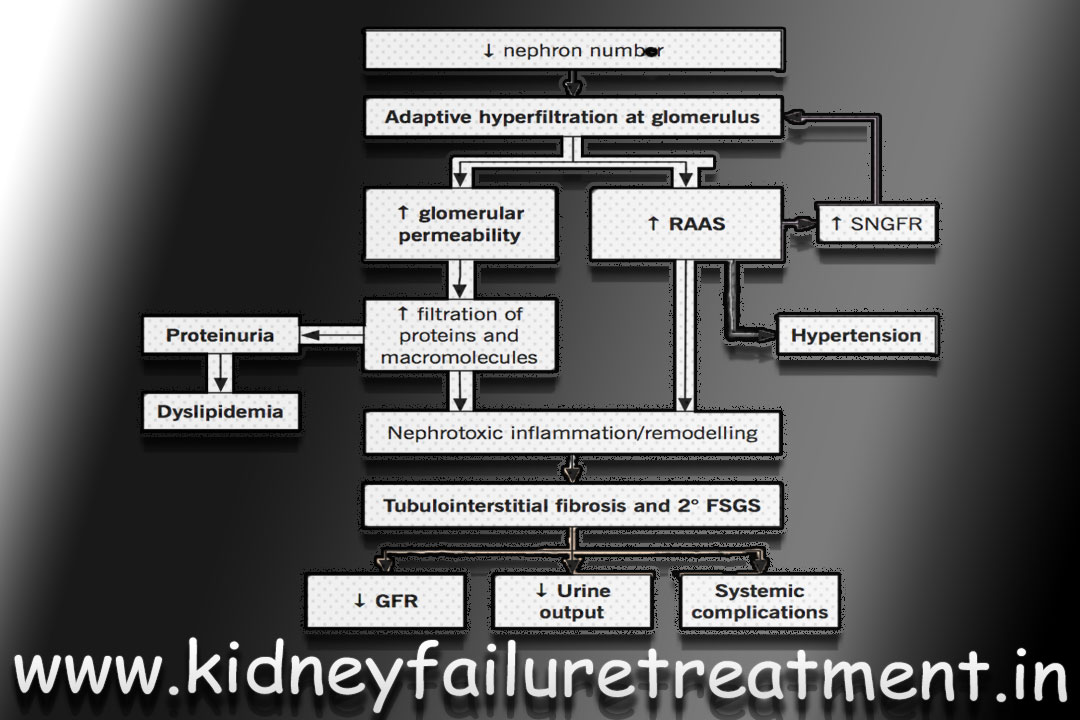 Kidney Failure Treatment In Maharashtra