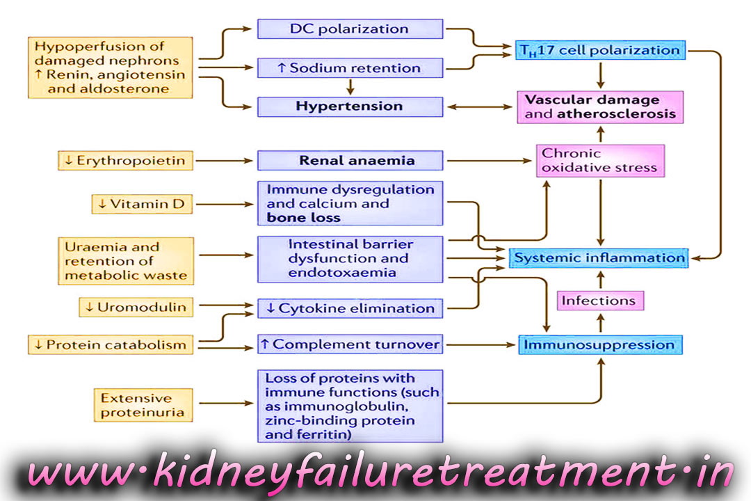 kidney failure treatment