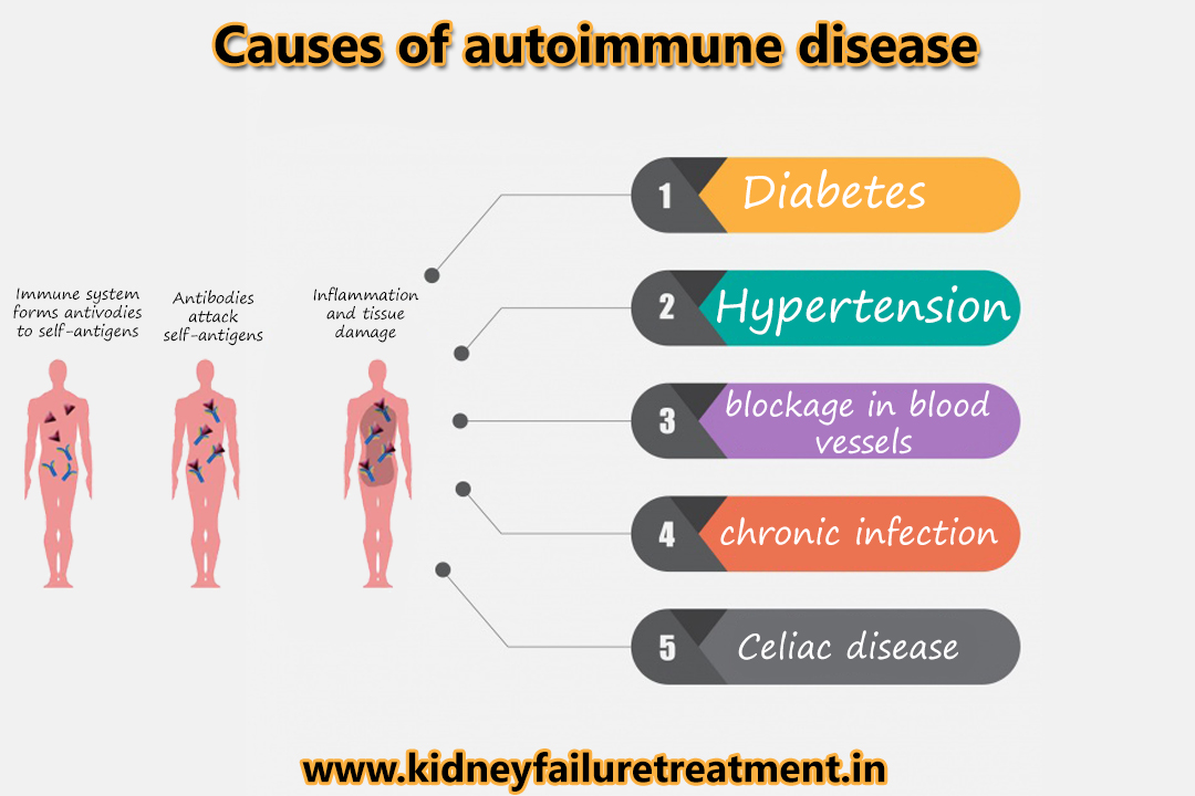 Is kidney disease autoimmune