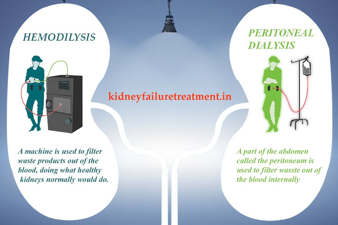 Once Dialysis Is Started Can It Be Stopped