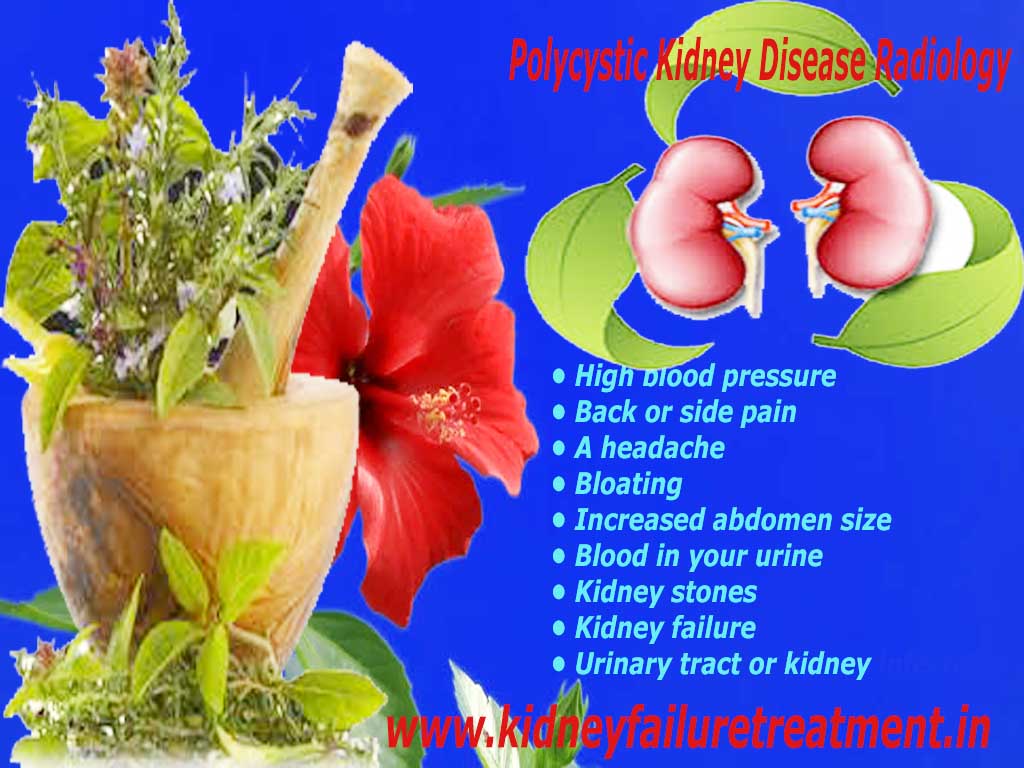 Polycystic kidney disease radiology