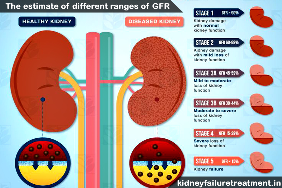 what does it mean when creatinine is high and gfr is low