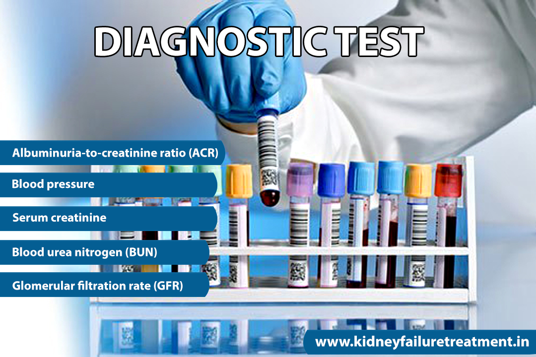 What Tests Diagnose Kidney Disease