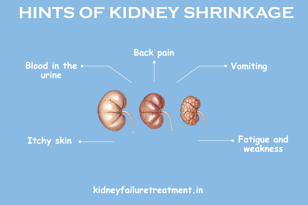 Is Kidney Shrinkage Curable