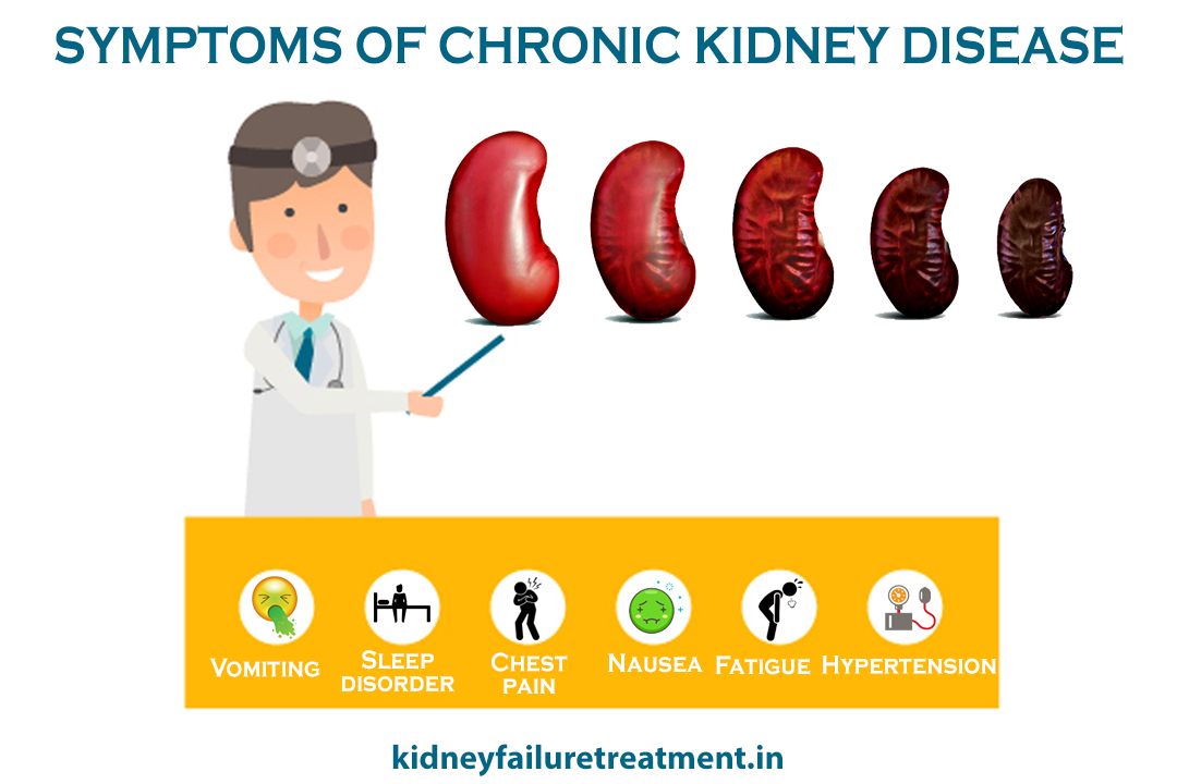 Life expectancy with chronic kidney disease