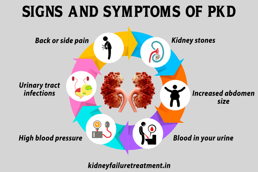 Polycystic-kidney-disease-sign,-causes,-and-symptoms
