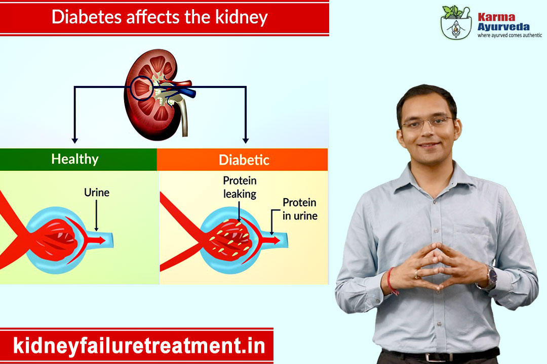 kidney-failure-review