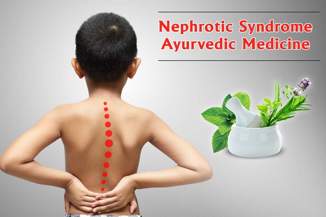 Is-Treating-Nephrotic-Syndrome-by-Ayurvedic-Medicine-Possible