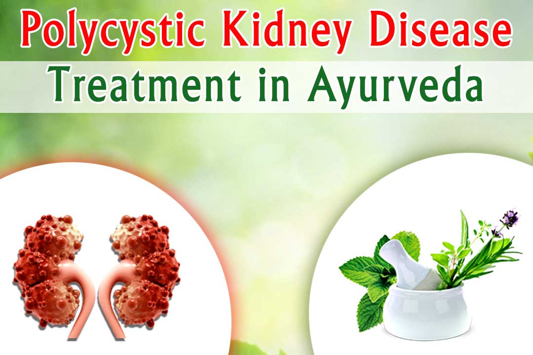 Polycystic-Kidney-Disease-Treatment-in-Ayurveda122