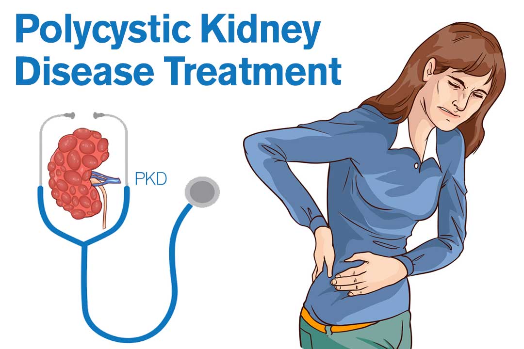 Polycystic-Kidney-Disease-Treatment