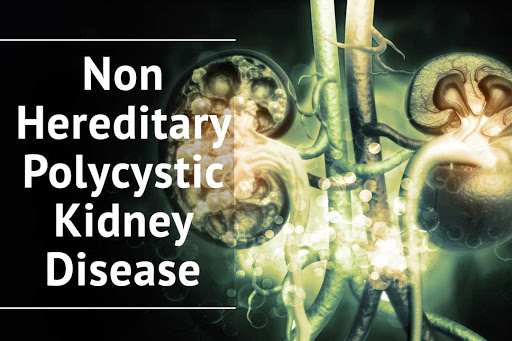 Ayurvedic treatment for non hereditary polycystic kidney disease