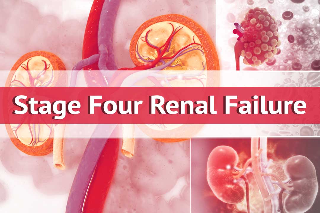 stage four renal failure