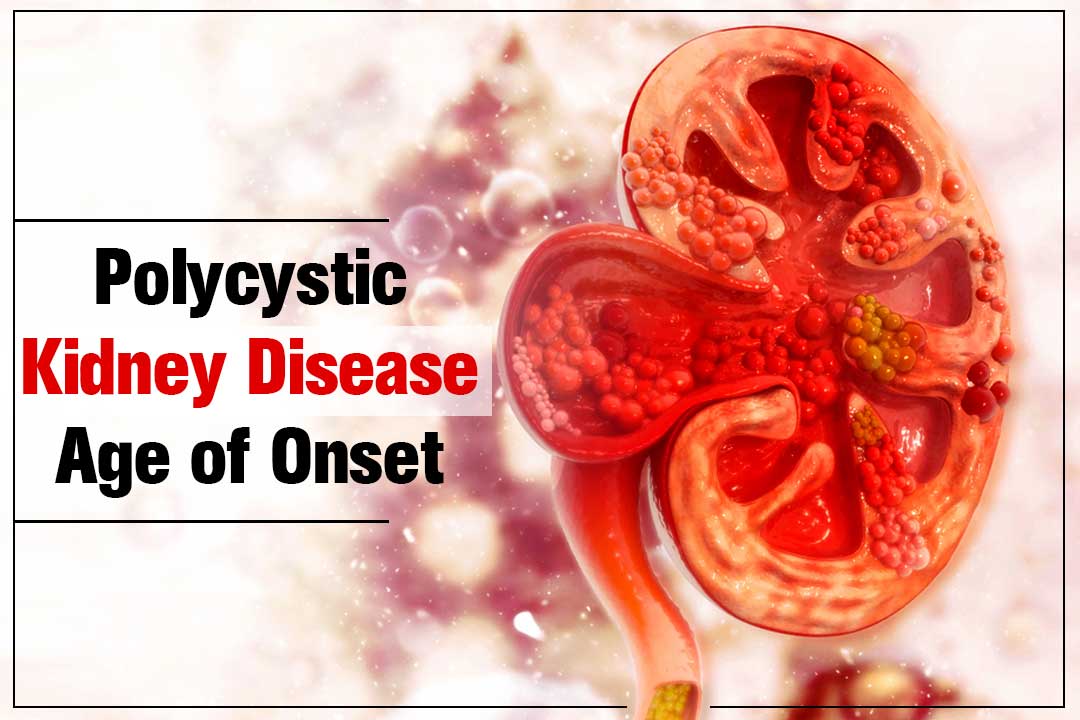 polycystic kidney disease age of onset