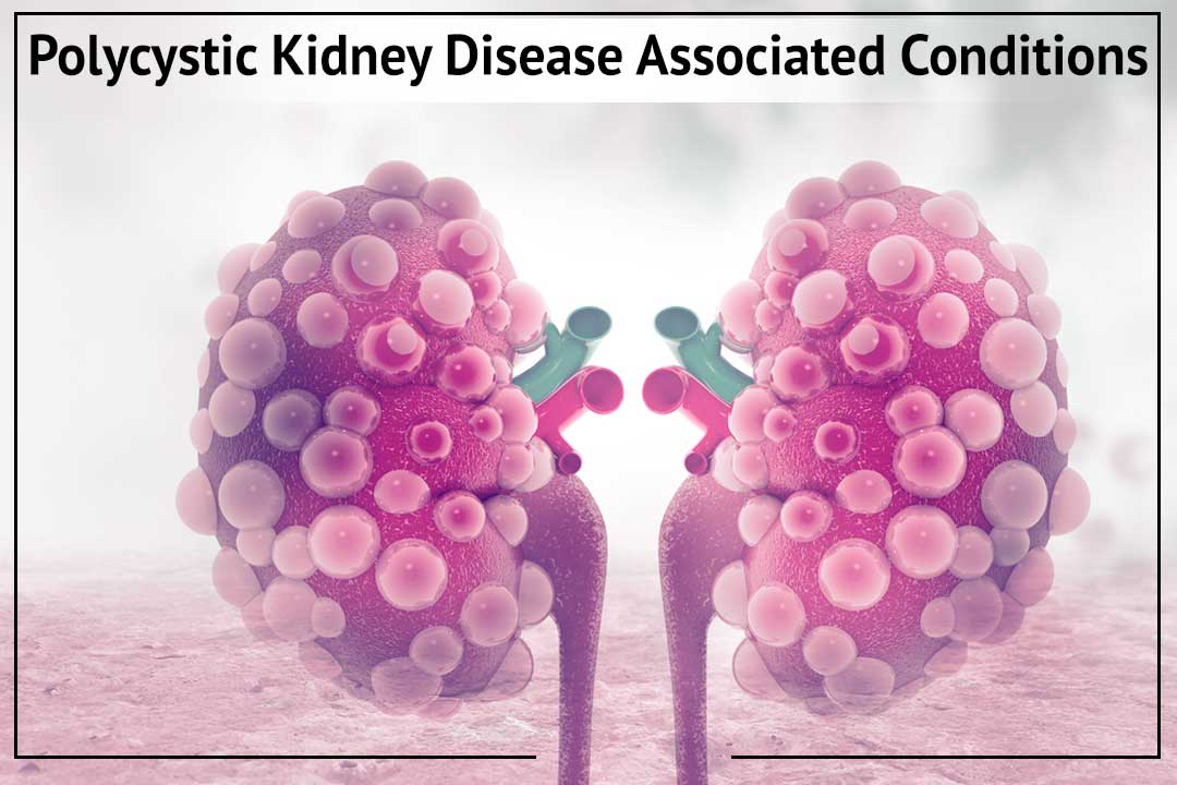 polycystic kidney disease associated conditions