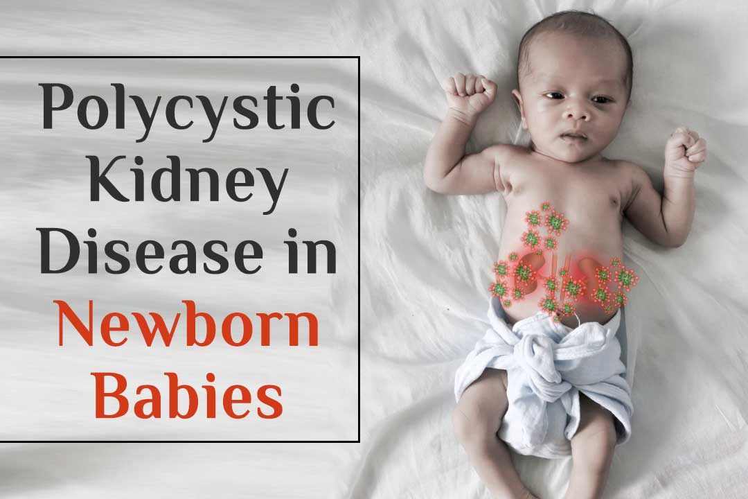 How to cure Polycystic kidney disease in newborn babies naturally?