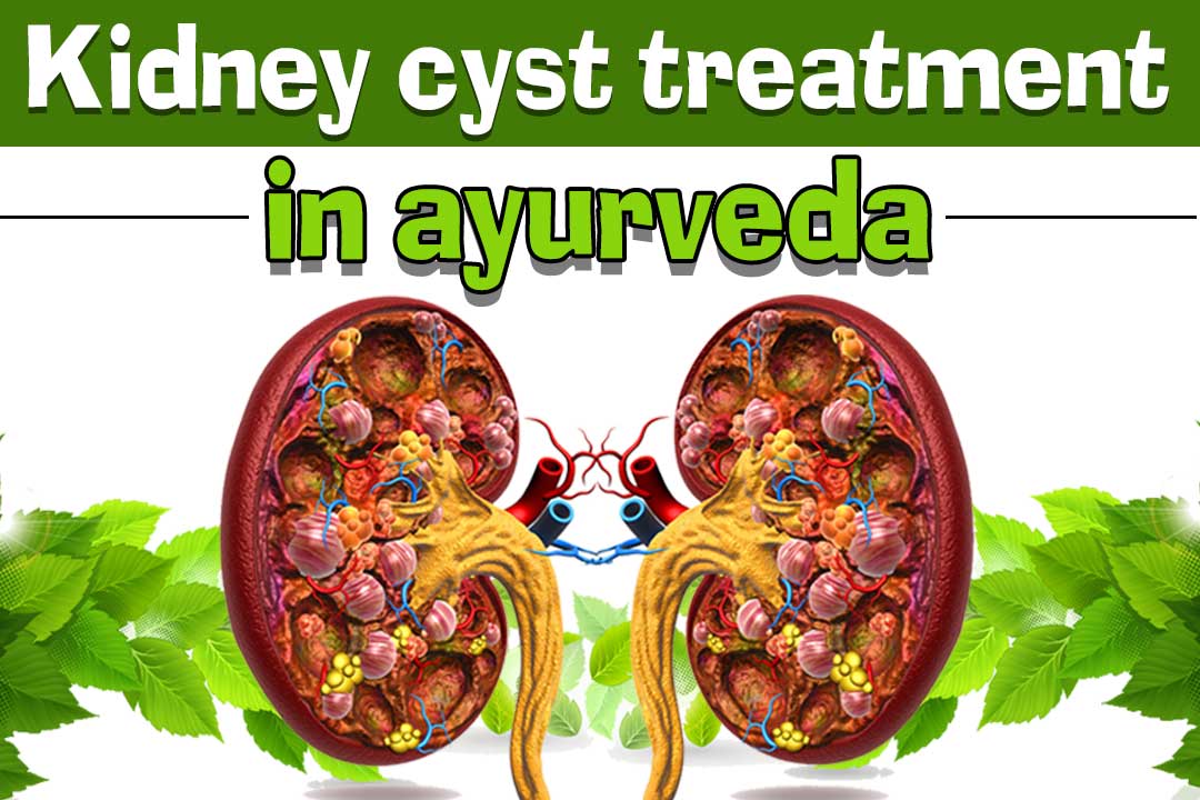Kidney cysts treatment in Ayurveda