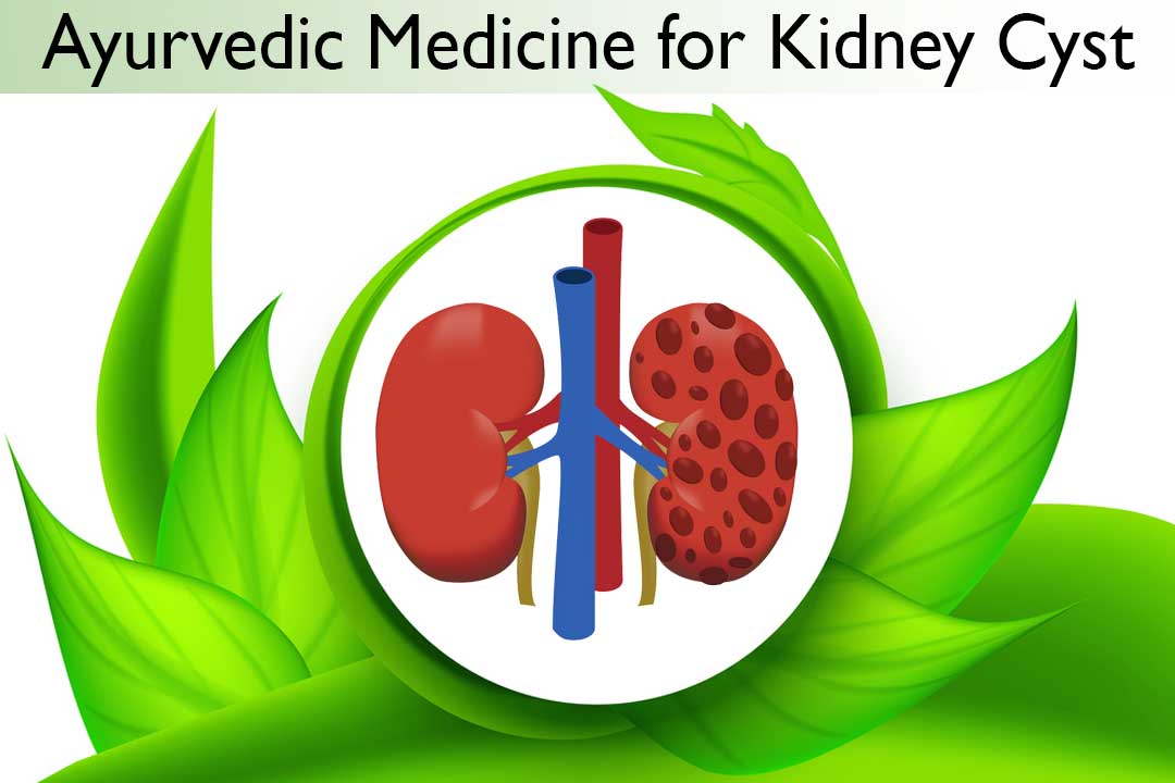 Ayurvedic medicines for kidney cyst
