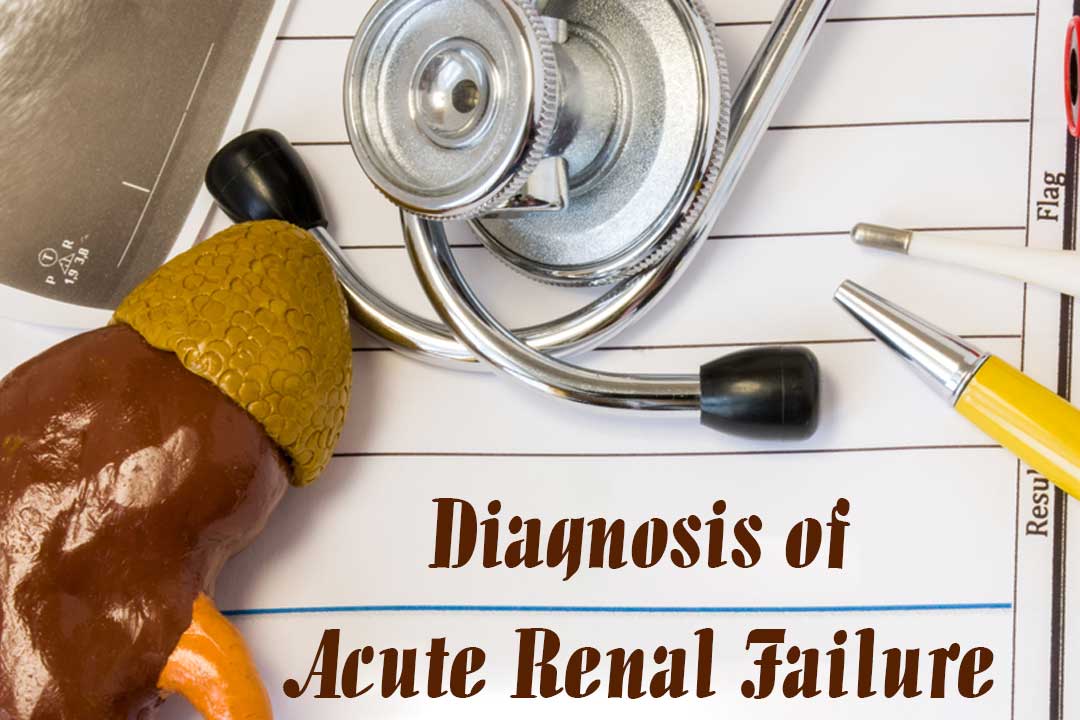 diagnosis of acute renal failure