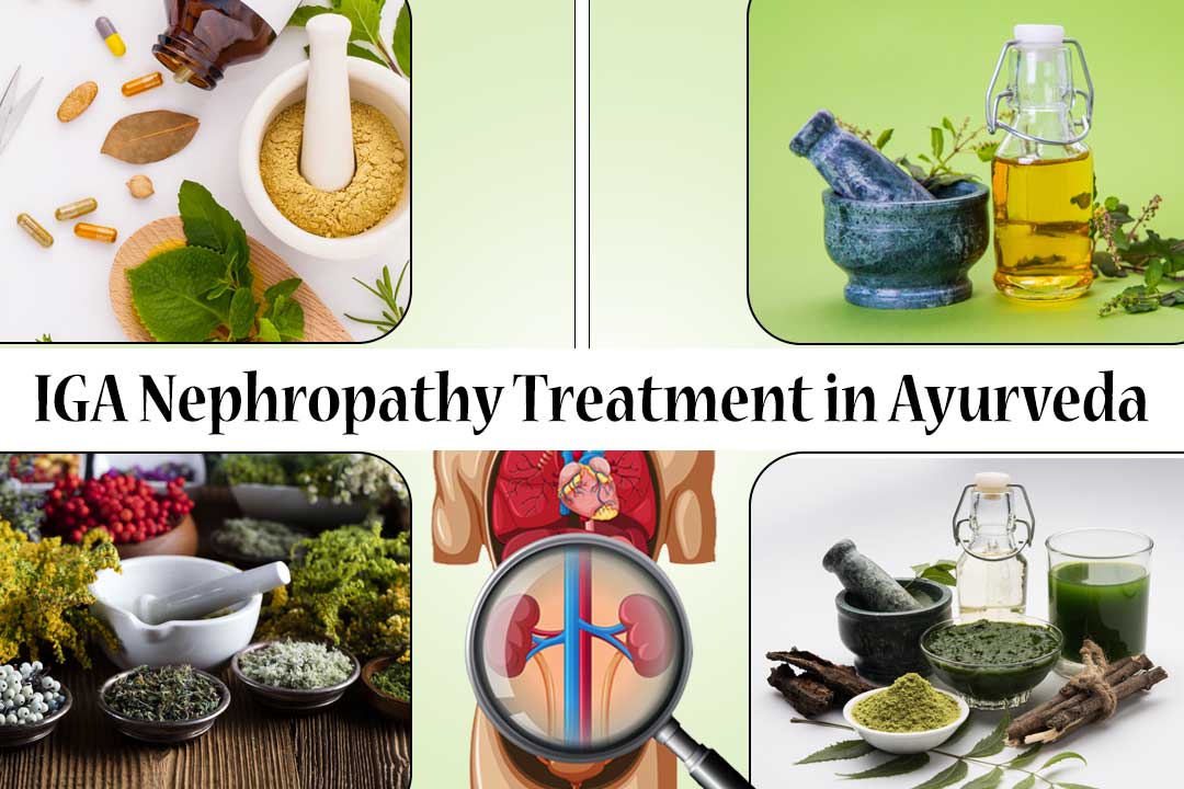 IgA nephropathy treatment in Ayurveda