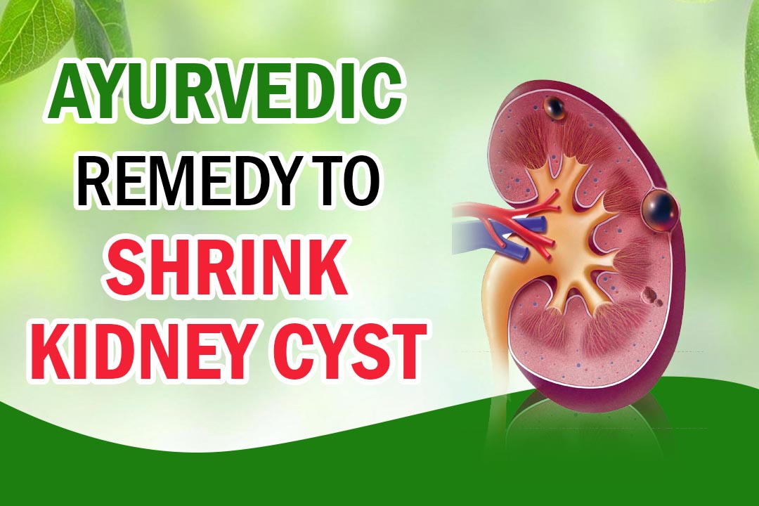 Ayurvedic Remedy To Shrink Kidney Cyst