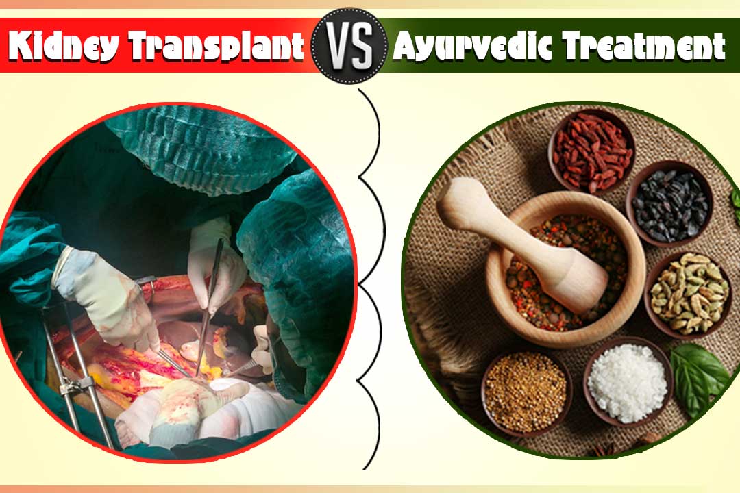 kidney transplant verses Ayurvedic treatment